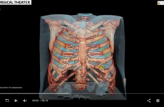 Videón nézhetik meg, mit tesz a koronavírus a tüdővel